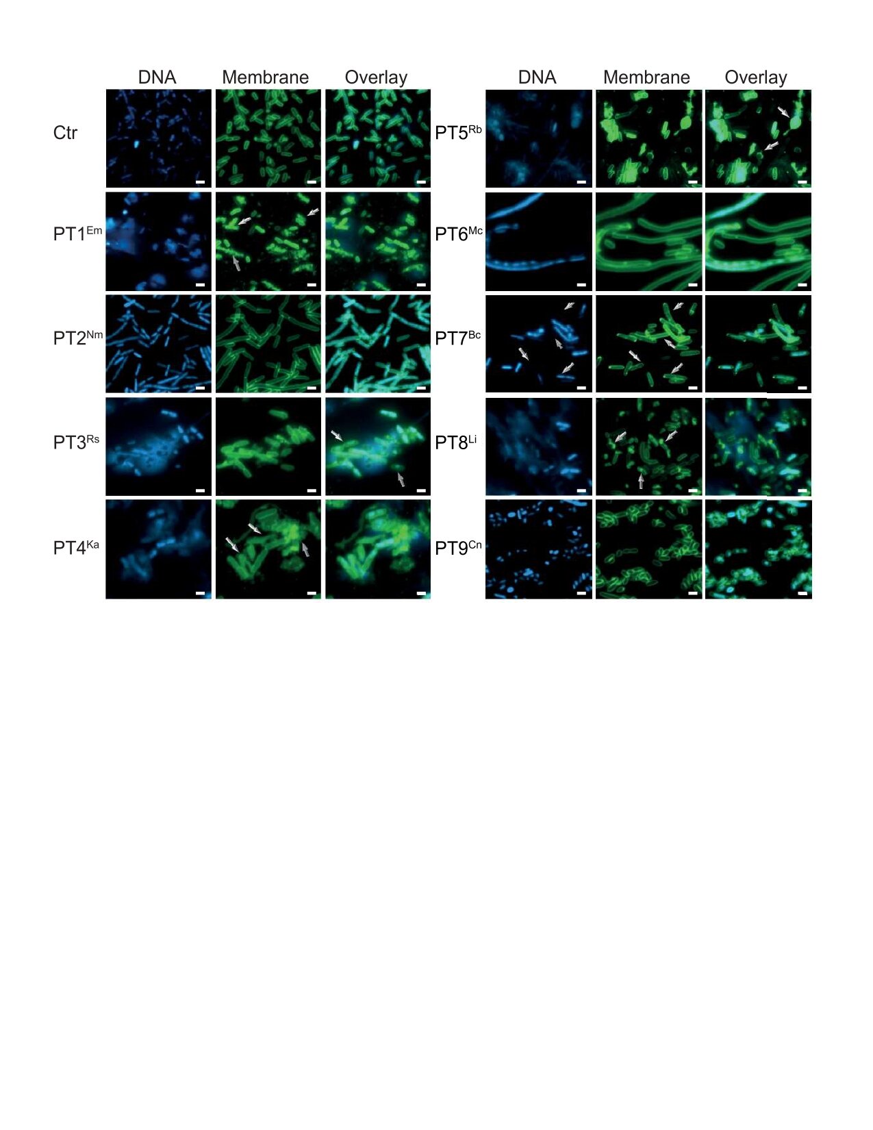 Discovery of new bacterial toxins could be key to fighting infections